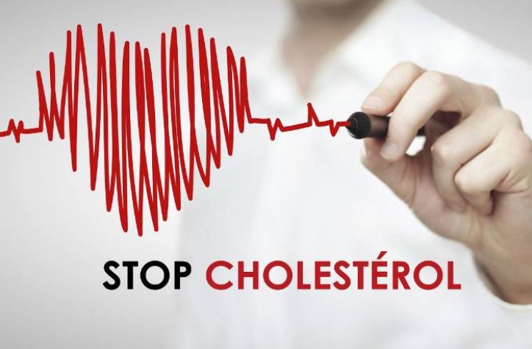 Ilustrasi kolesterol.