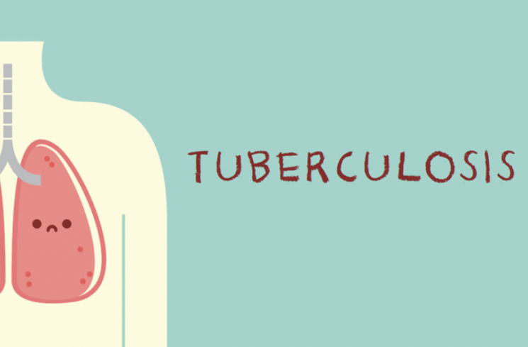 Ilustrasi gambar TBC (Tuberkulosis)